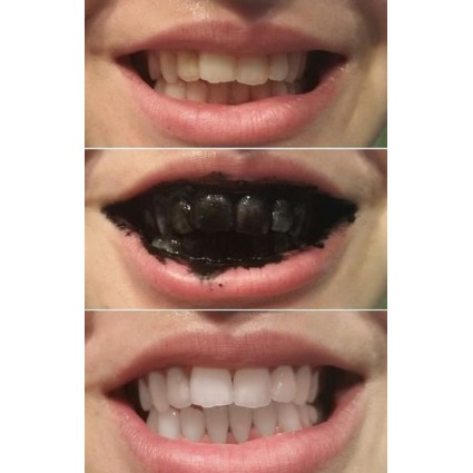 Teeth Whitening 100 Organic